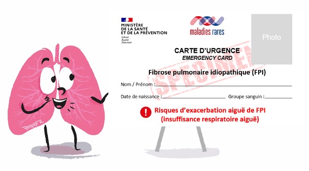 La carte d'urgence pour la FPI