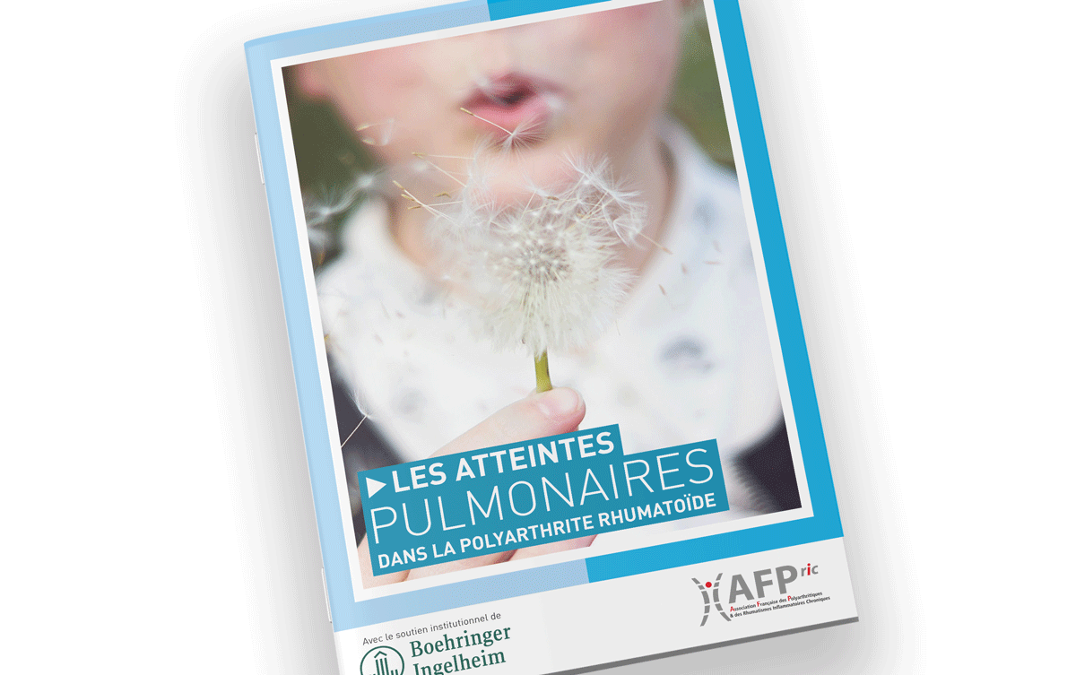 Les atteintes pulmonaires dans la polyarthrite rhumatoïde